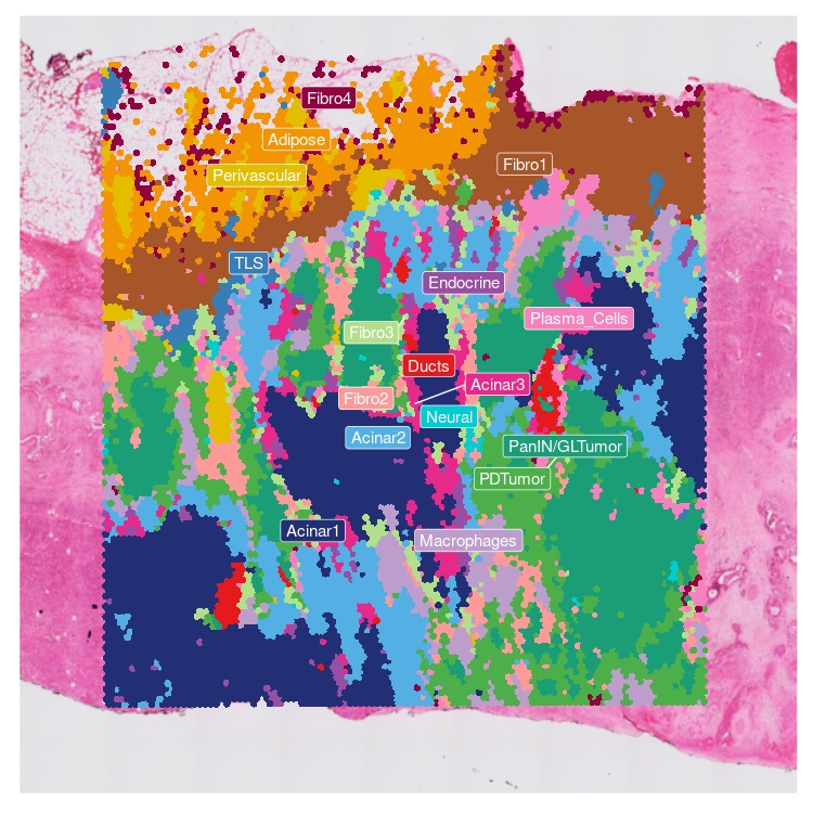 Spatial transcriptomics sample